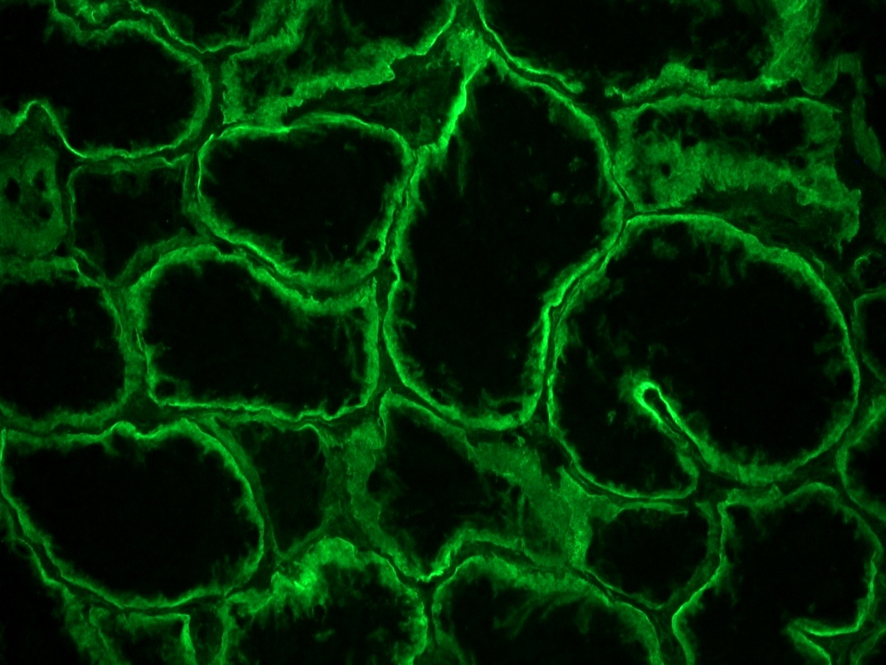 Figure 2: Integrin alpha 6A immunostaining of the basolateral membrane of epithelial cells in a frozen section of human kidney using MUB0908P.
